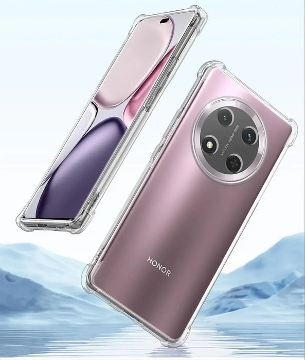 CEVA 2-in-1 Honor Magic7 Lite Protection Package